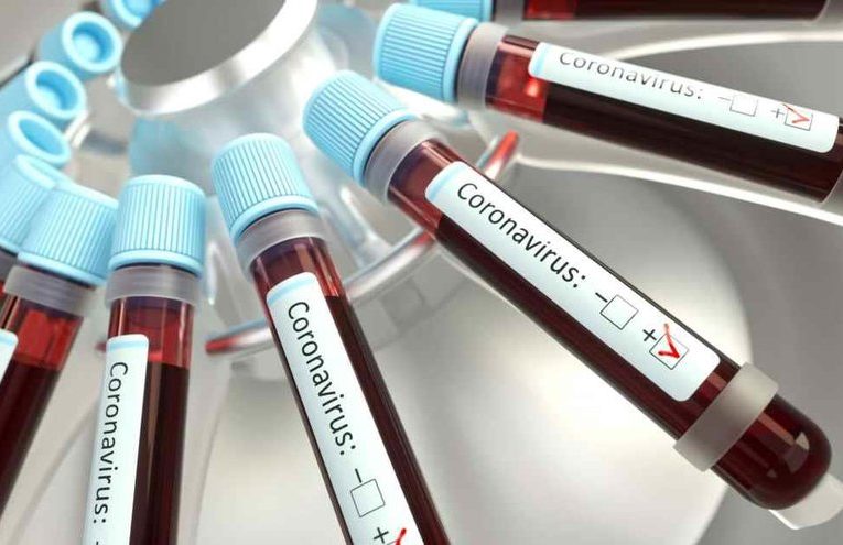 В Ингушетии за сутки коронавирус выявлен у 56 человек